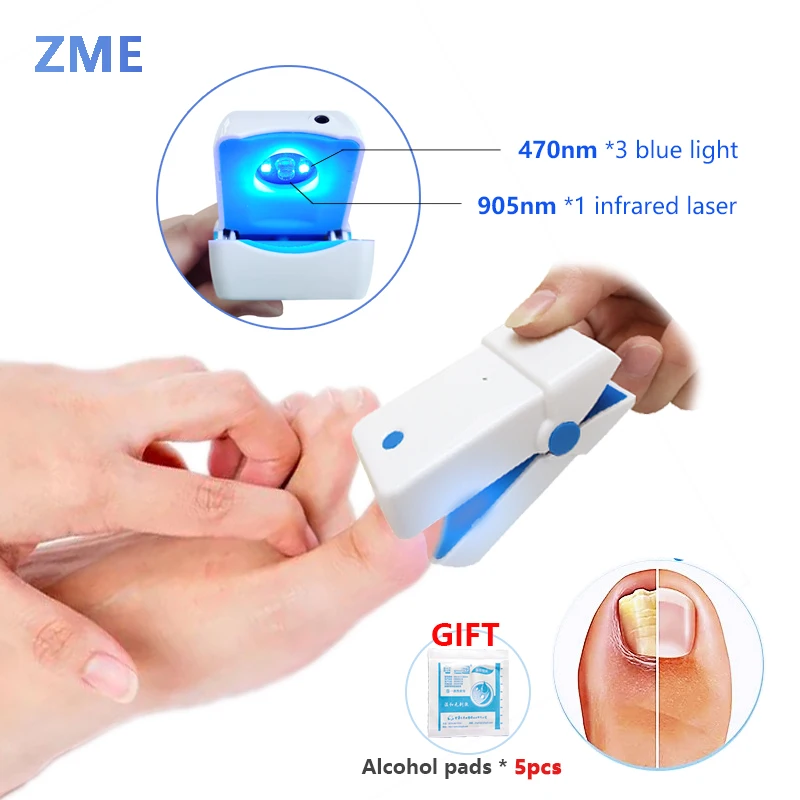 ZME Nail Fungus Laser Device Nail Fungus Treatment Onychomycosis