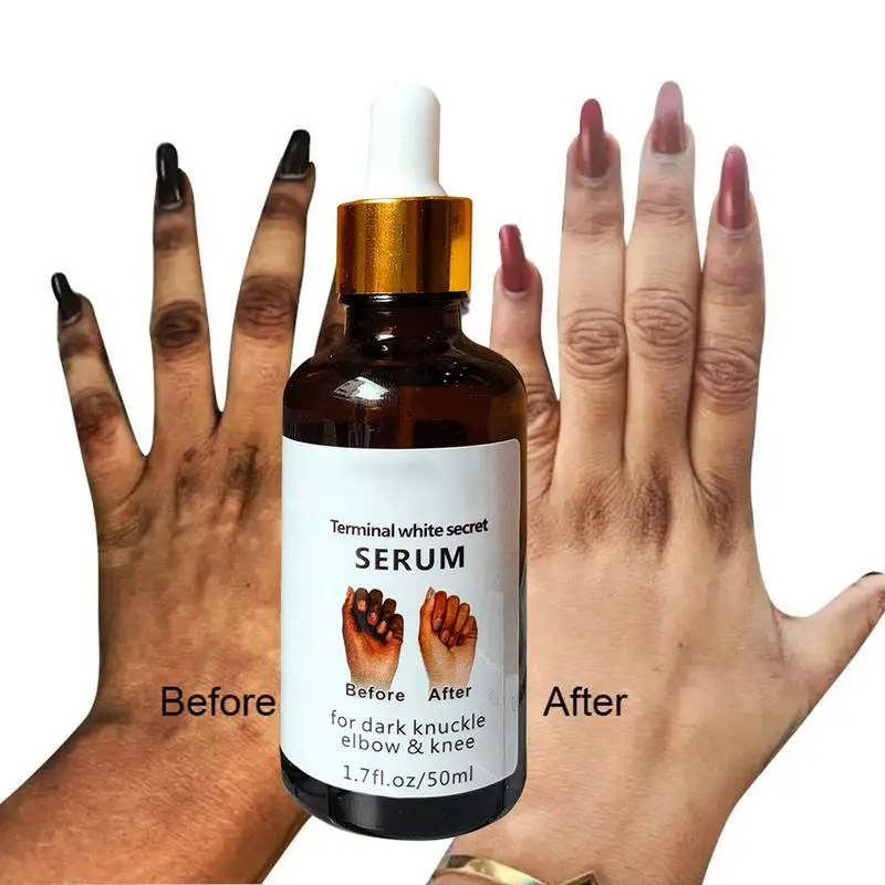 

50ml Hand Brightening Lotion Whitening Easy Remover Black Fingers Moisturizing Hand Essence Melanin Glow Drops For Women Men