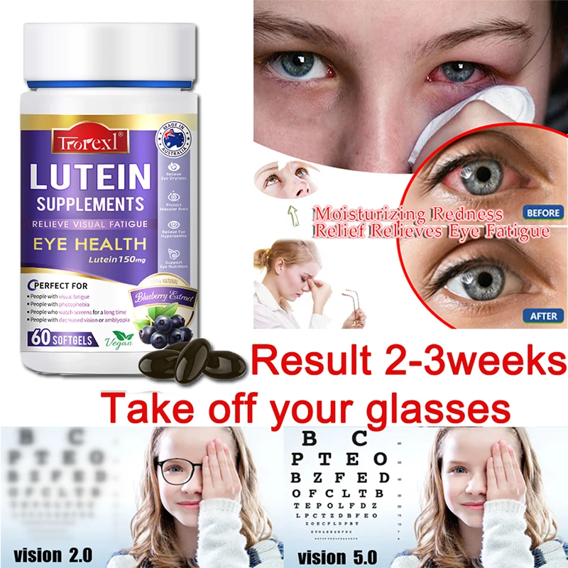 

Trorexl Improve Vision Quickly Restore Vision Myopia Supplement Lutein Extract for Eye Strain Relieve Eye Fatigue Red & Dry Eye