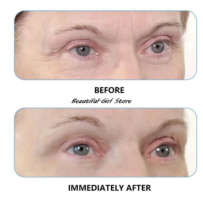 Face Cream 100ml Eye Cream 30ml Roth Instant FIRMx Temporary Face Tightener Firm Smooth Deep Wrinkles Pores face cream,skin cream