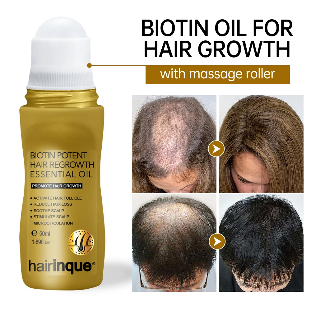 

Biotin Oil For Hair Growth Products Men Women Anti Hair Loss Roller Scalp Massager Treatment Fast Grow Bald Serum Hair Oil Care