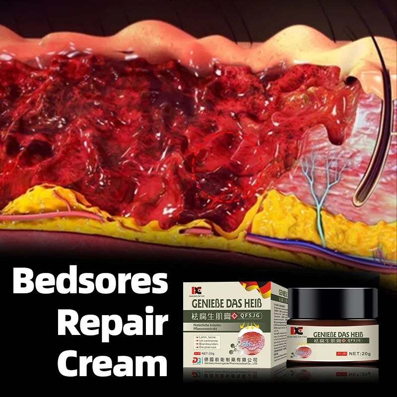 

Bedsores Remove Rots Myogenic Cream Anti Bed Sore Wound Healing Treatment Pressure Ulcer Decubitus Medicine Germany Ointment