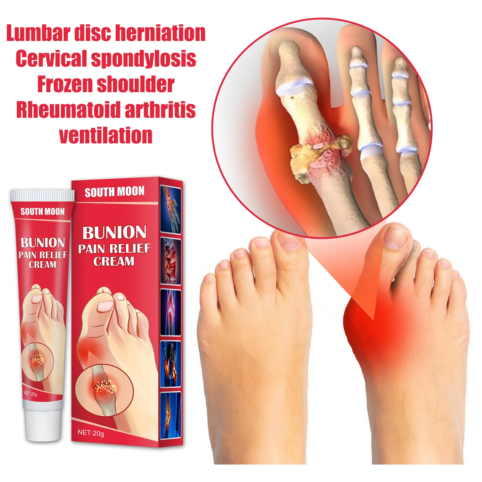 20g Bunion Gout Pain Relief Ointment Toe Joint Valgus Corrector Cream