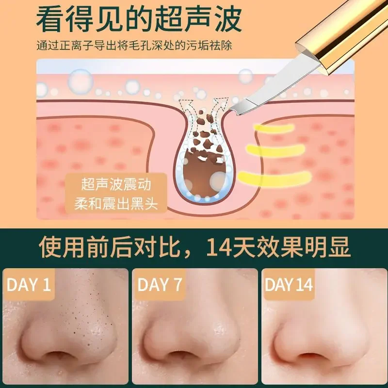 Ultrasonic Blackhead Skinner Beauty Instrument Household facial pore acne cleaning blackhead suction instrument artifact