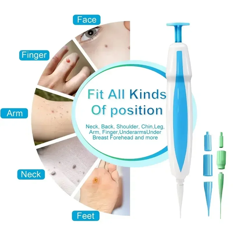 3 In1 Painless Auto Skin Tag Mole Wart Removal Kit Cleaning Tools Face Skin Care Body Wart Dot Treatments Remover Beauty Health skin tag removal tool skin tag removal pen