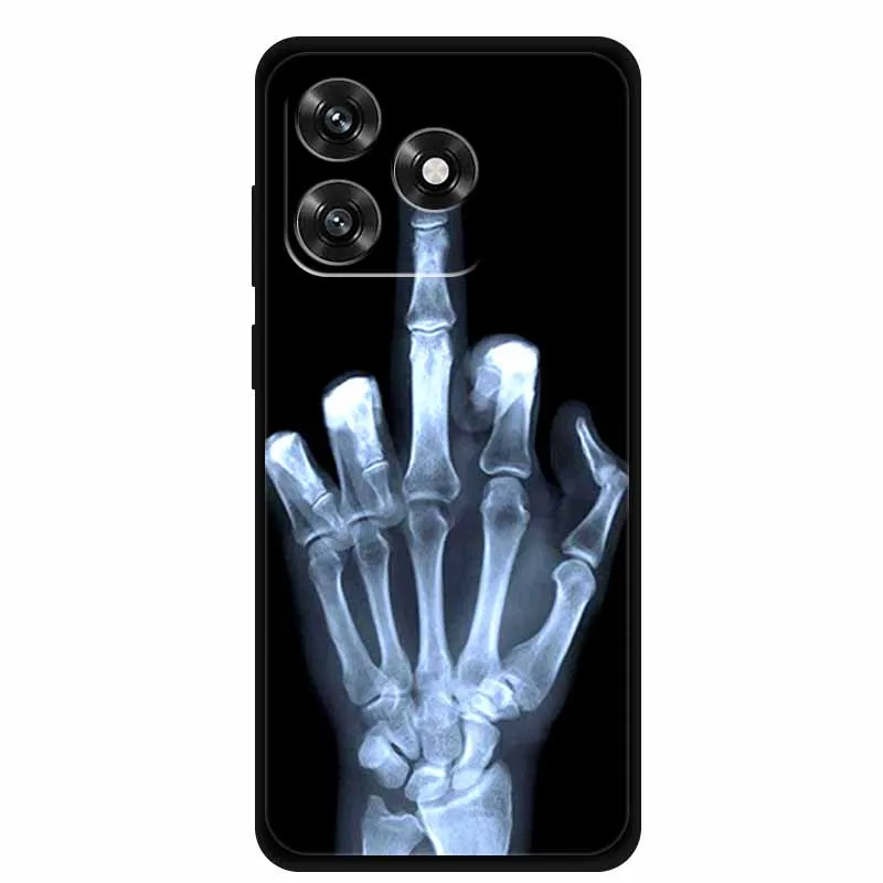 Luxury Soft Silicone Shockproof Protective Phone Case, 6.74