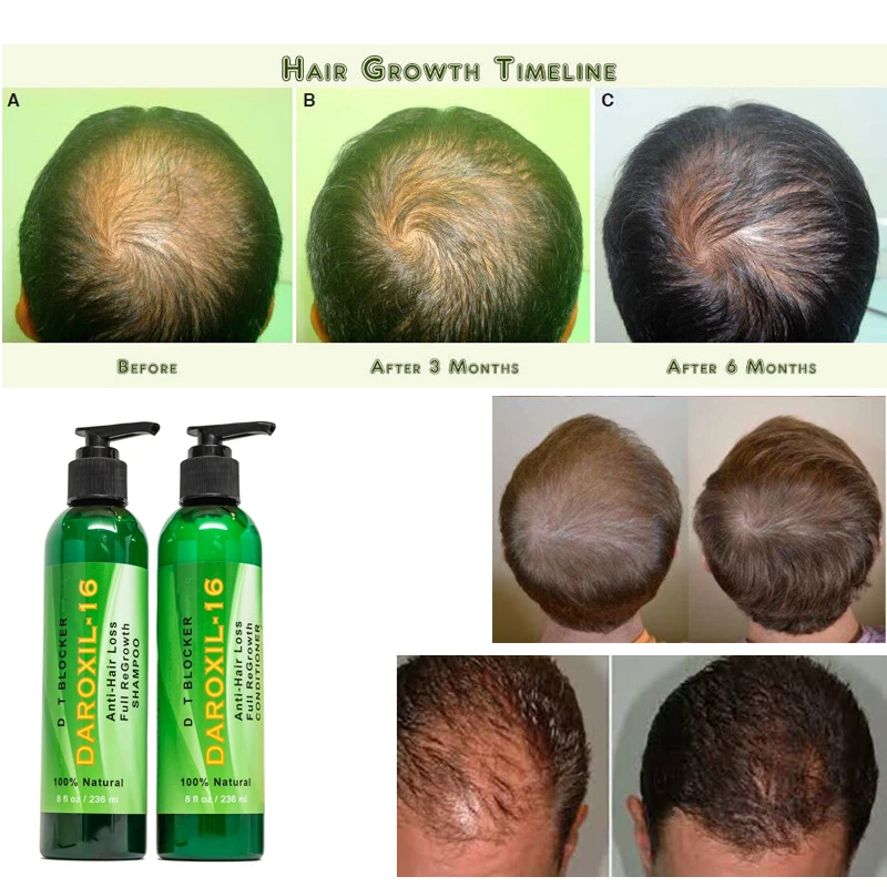 DAROXIL-16 Hair Styling Maintenance Dryness, Brittle, Repair Full Re-Growth Natural Fast Thick Dark And Shiny For Men Women