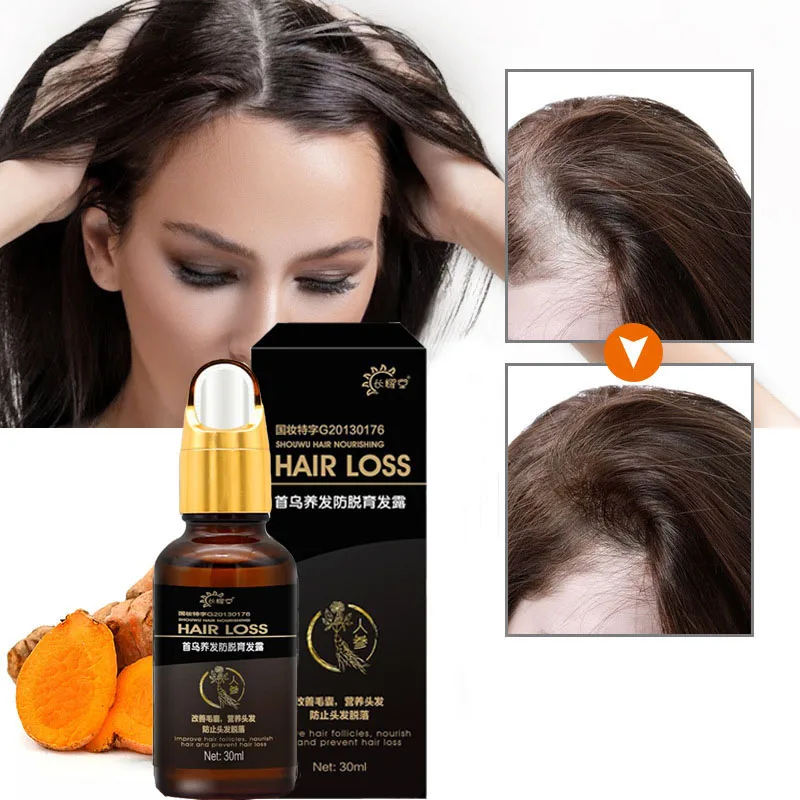Hair Growth Products Fast Growing Oil Loss Care Liquid Beauty &amp Scalp Treatment Dense Serum |