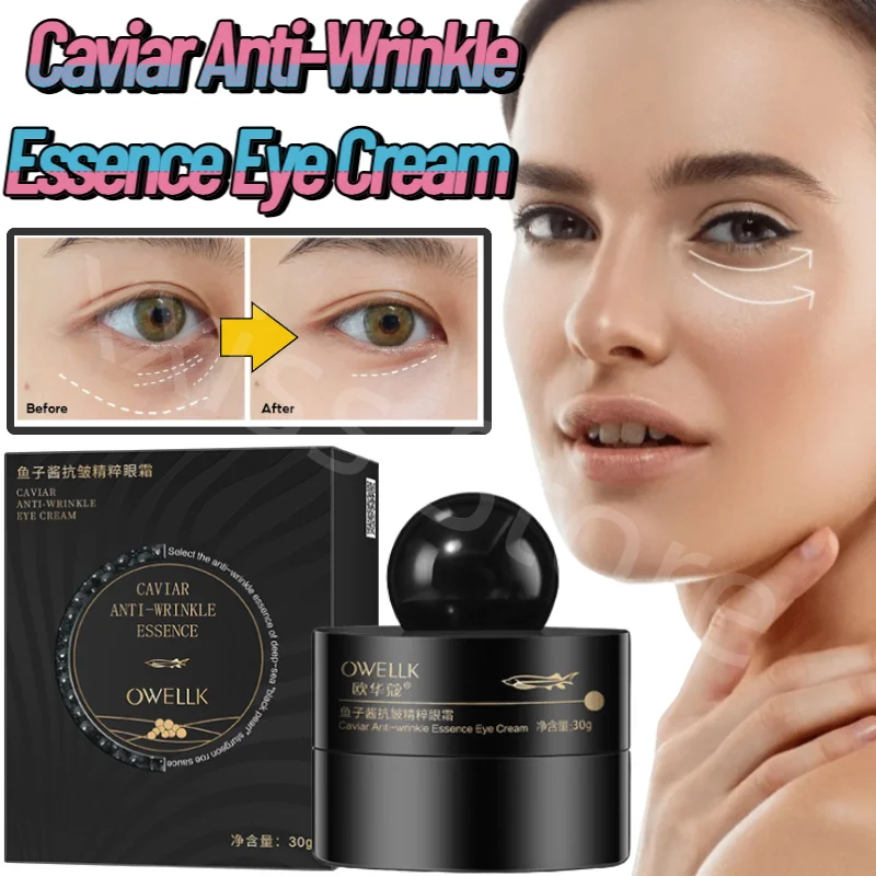 

30g Caviar Anti-Wrinkle Eye Cream Eye Care Lifts, Firms and Diminishes Dark Circles and Eye Bags Essence Eye Care Anti-aging