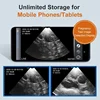 Wireless Mechanical Veterinary Ultrasound Scanner Portable Pregnancy Test Handheld Ultrasound Machine Pig Sheep 3