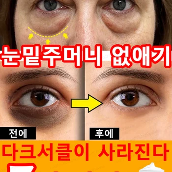 아이크림 눈 밑 처짐을 없애고, 붓기와 다크서클을 없애줍니다.