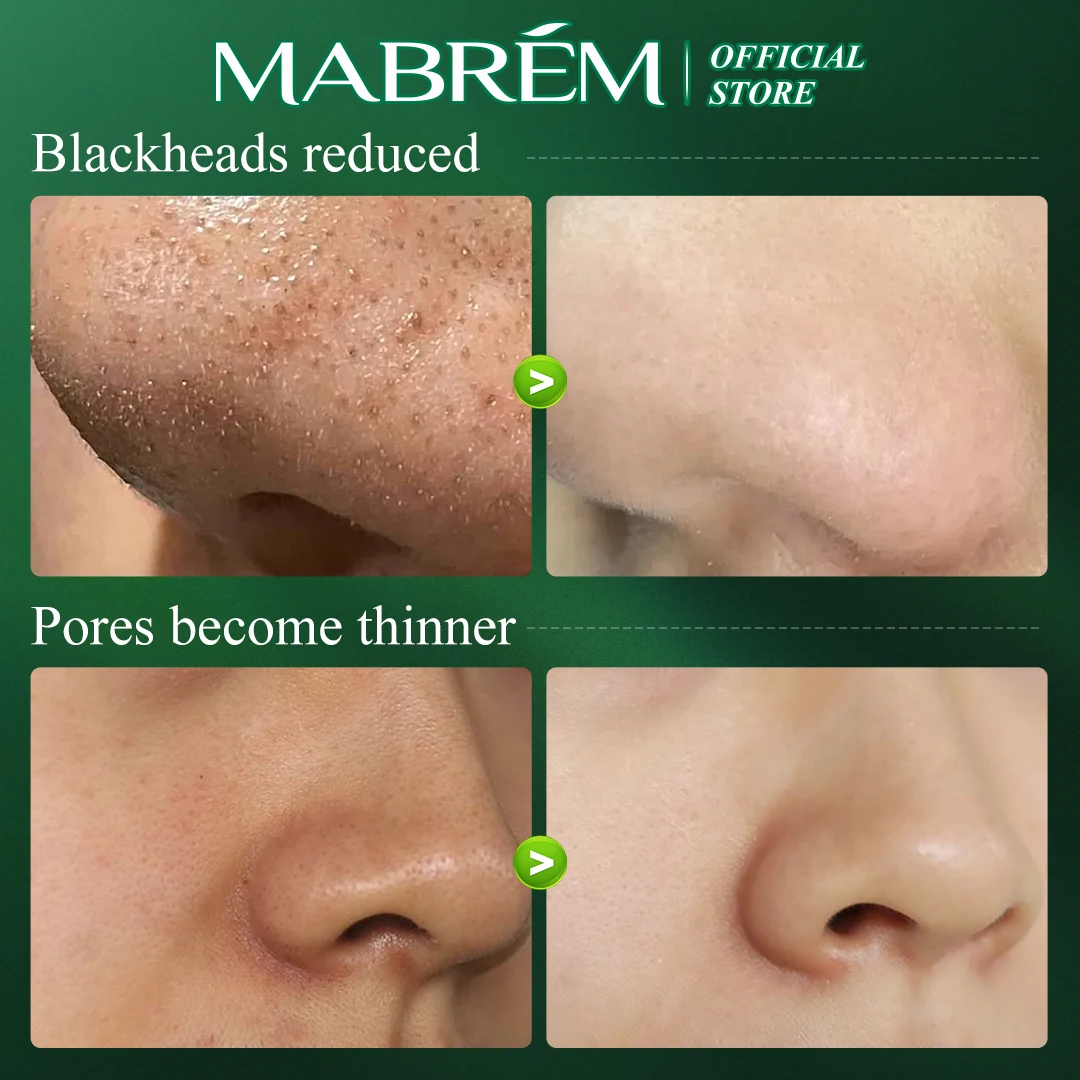 Remove Blackhead Mask Nasal Membrane Skin Care Bamboo Charcoal Gentle Pore-shrinking Nose Patch Deep Cleansing