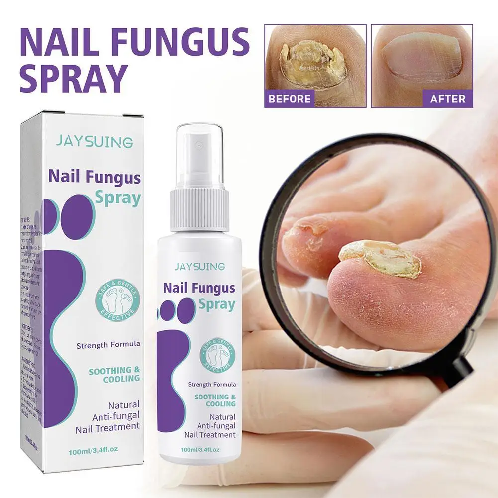 100ml Effective AntiFungal Feet Infections Athlete Foot Nail Fungus