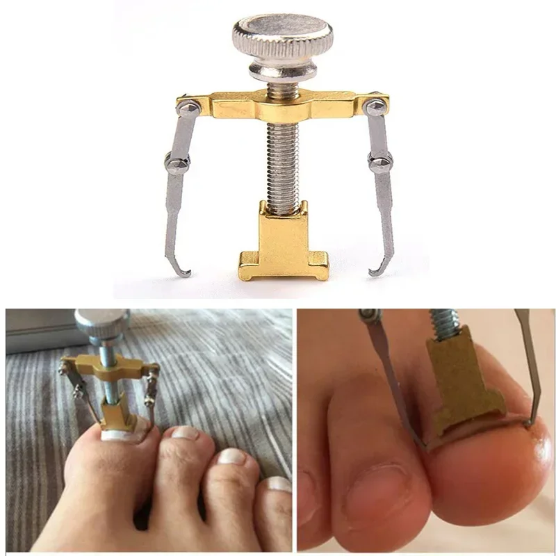 

1pc Ingrown Toenails Corrector Stainless Steel Nail Straightening Tool Relief Pain Pedicure Tool Professional Toe Nail Care