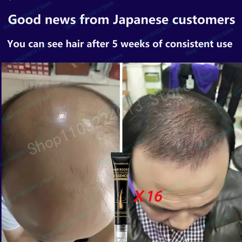 Description Picture 4 of itemAnti Alopecia Fast Hair Growth Oil Ginger Essential Serum Hairless Baldhead Increase High Hairline Natural Head Hair Essence
