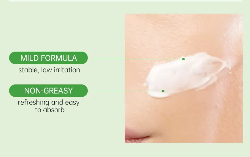 acne, cuidados com a pele, controle de