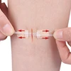 Strap Zipper Wound Closure Patches Breathable Seamless Elastic Zip Sutures Bandages For Wound Care Braces Supports 3