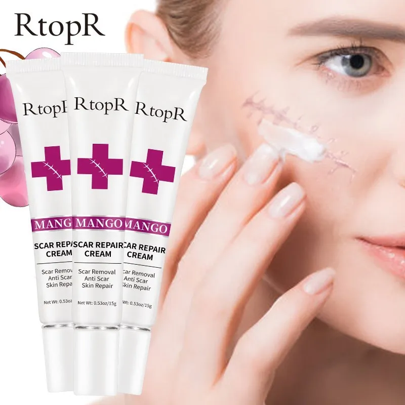 

Acne Scar Stretch Marks Remover Cream Skin Repair Face Cream Acne Spots Acne Treatment Blackhead Whitening Cream Skin Care 3pcs