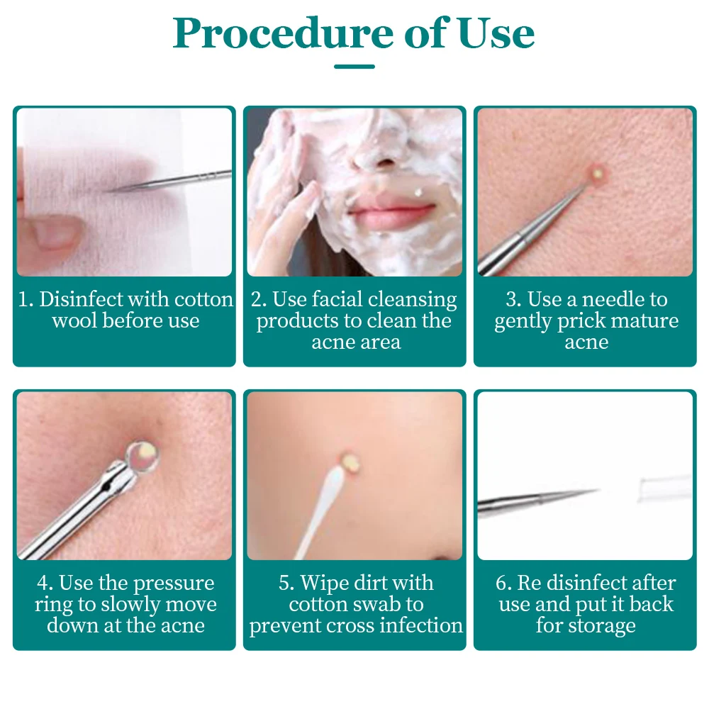Ultra Fine No 5 Cell Pimples Black Head Clip Tweezers Beauty Salon Special Scraping Closing Artifact Acne Needle Tool 4