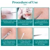 Ultra Fine No 5 Cell Pimples Black Head Clip Tweezers Beauty Salon Special Scraping Closing Artifact Acne Needle Tool 4
