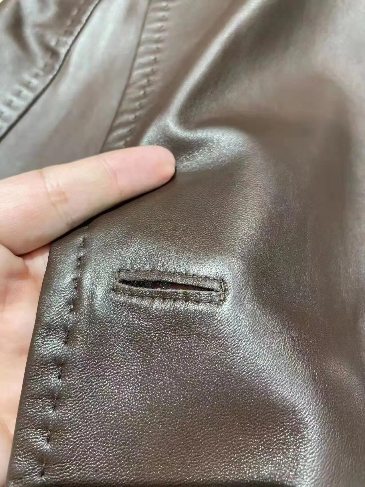 thumb