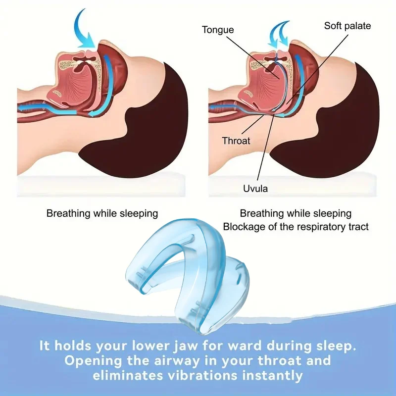 Mouth Guard Anti Snoring Soft Mouthpiece Comfortable Snoring Solution Adjustable Night Sleep Aid Bruxism Mouthpiece 6