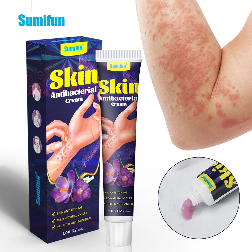 

30g Only$1.09 Sumifun Skin Antibacterial Cream Psoriasis Dermatitis Urticaria Eczema Massage Ointment Anti Itch Medical Plaster