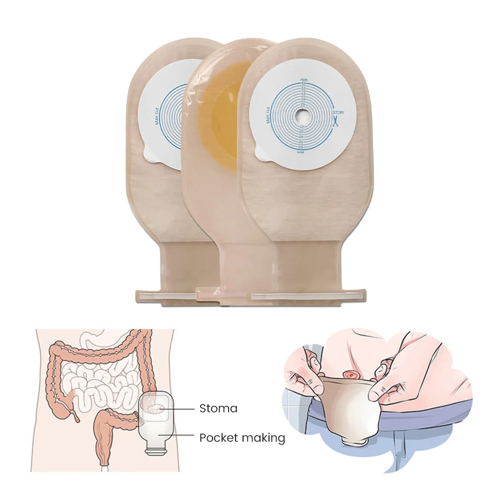 

Colostomy Bags Super Size 85mm Hole One-piece Drainable Ostomy Bags Stoma Care With Clips Colostomy Bag Skin Color 10PCS