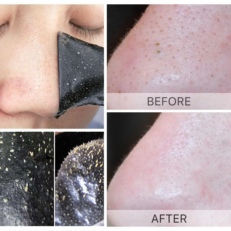 Unisex Blackhead Remove Mask Peel Nasal Strips Deep Shrink Cleansing Pore Nose Black Head Remove Stickers Skin Care Mask Patch 6
