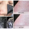 Unisex Blackhead Remove Mask Peel Nasal Strips Deep Shrink Cleansing Pore Nose Black Head Remove Stickers Skin Care Mask Patch 6