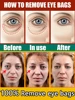 Remove bags Puffiness away work under eyes 4