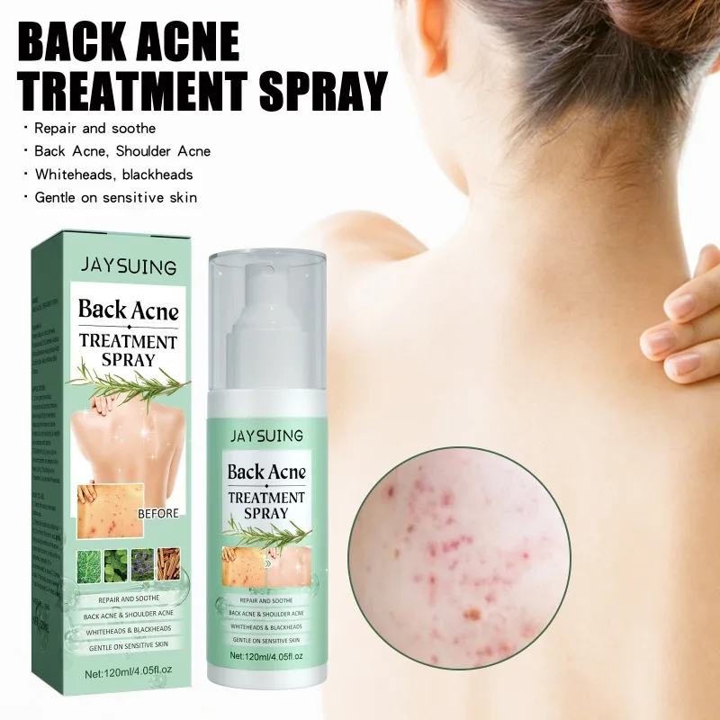 Acne Cover Cream Back Acne Treatment Spray Moisturizing Repair Sooth Remove Whiteheads Blackheads Oil Control Pimples