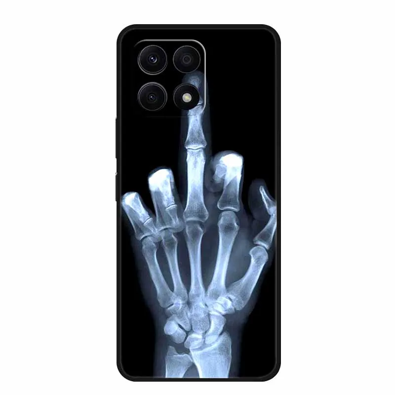 Lion Wolf TPU Silicone Protective Case - Soft Printed Cover
