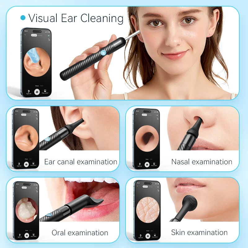 Wireless Ear Wax Removal Camera Rechargeable Ear Cleaner 8 Megapixels 6 Pcs Spoon Set Canal Clean