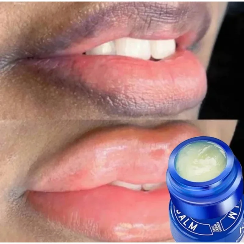 Remove Dark Aloe Lip Balm Lightening Melanin Mask Lip Gloss Oil  Exfoliating Clean Moisturizer Makeup Korean Beauty Products 2
