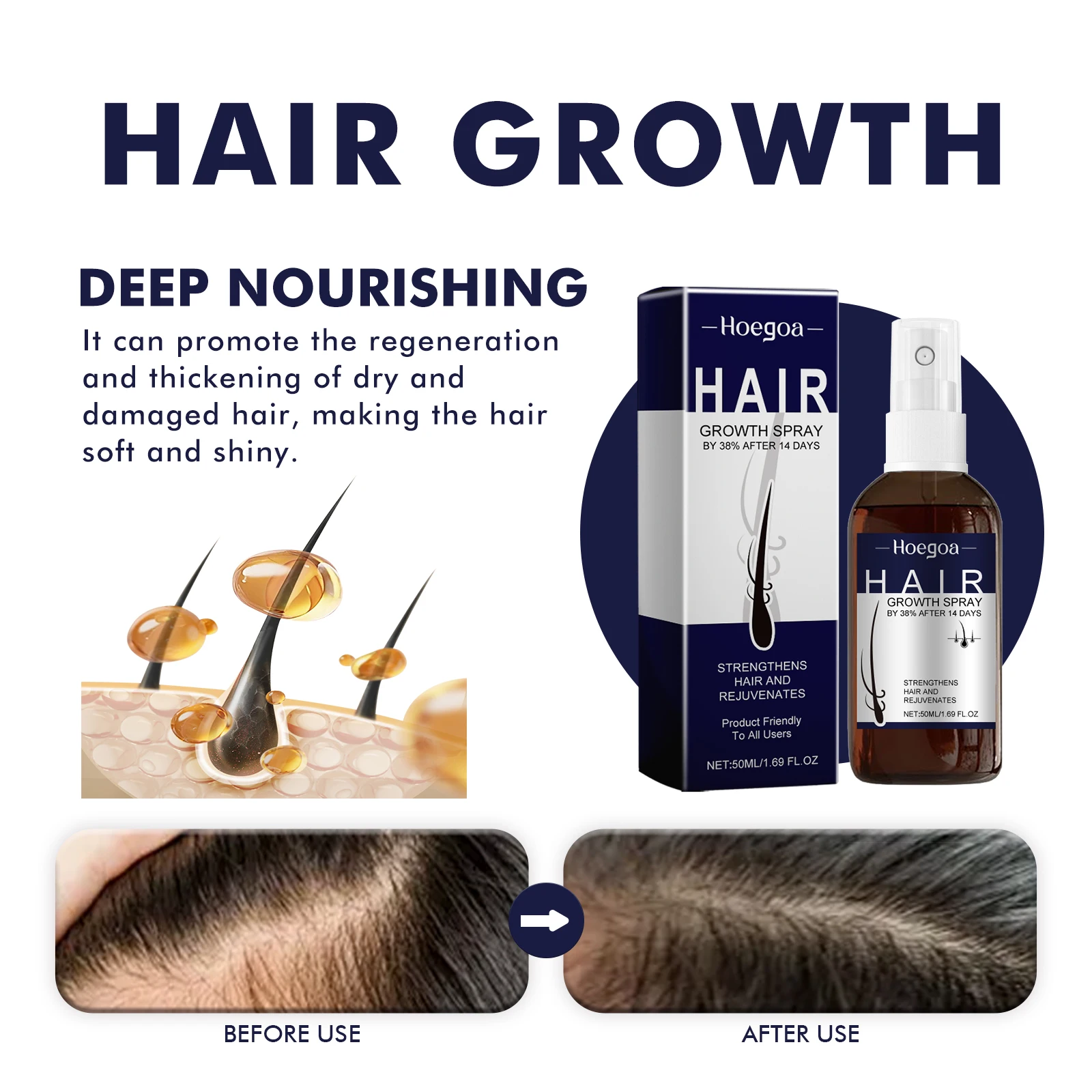 Hair Growth Spray Prevent Baldness Treatment Scalp Dry Damaged Split Hair Dense Strengthen Nourishing Smoothing Massage Liquid