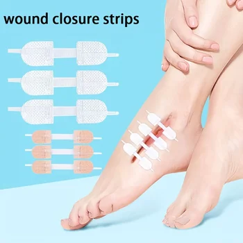 Confezione da 6 strisce per la chiusura delle ferite, nastro per ferite senza sutura, kit per la chiusura delle lacerazioni a zip per la cura dei tagli.