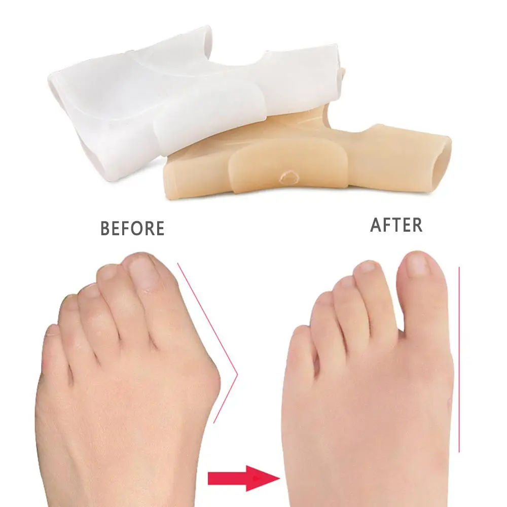 

Silicone Toes Separator Bunion Bone Ectropion Adjuster Toes Outer Appliance Hallux Valgus Corrector Foot Care Tools Health