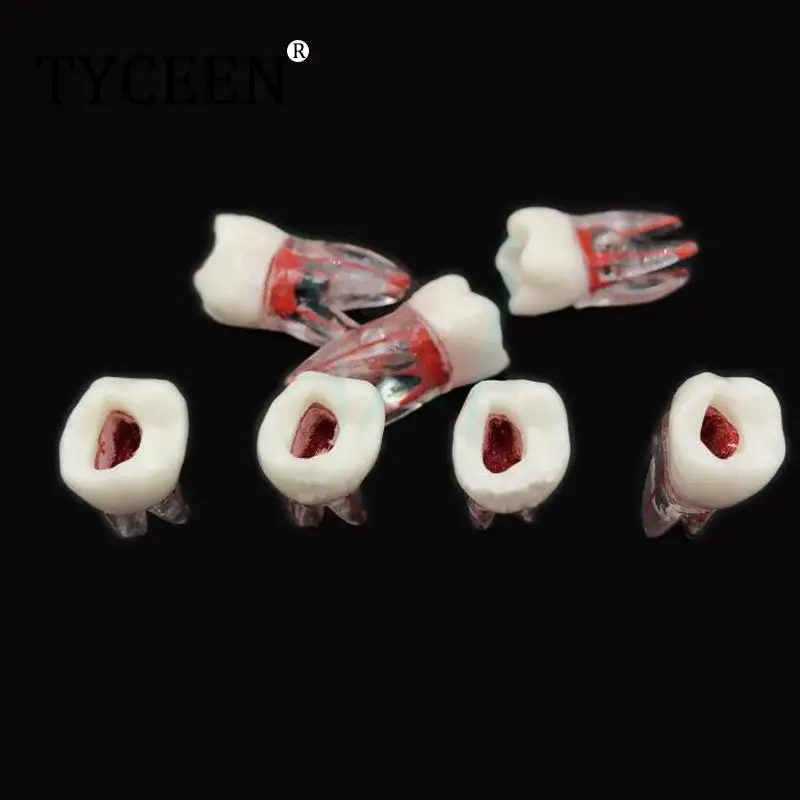 

1Pc Dental Tooth model Root Canal RCT Practice Pulp Cavity Clear Resin Teaching teeth model 1:1 Dental Model Dentist Tools