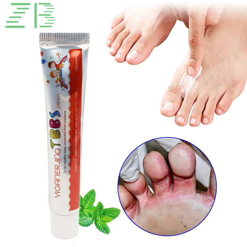 

ZB 15g Psoriasis Cream Treat Athlete's Foot Eczema Dermatitis Anti-itch Inhibit Fungi Medical Cream Skin Heath Care Ointment