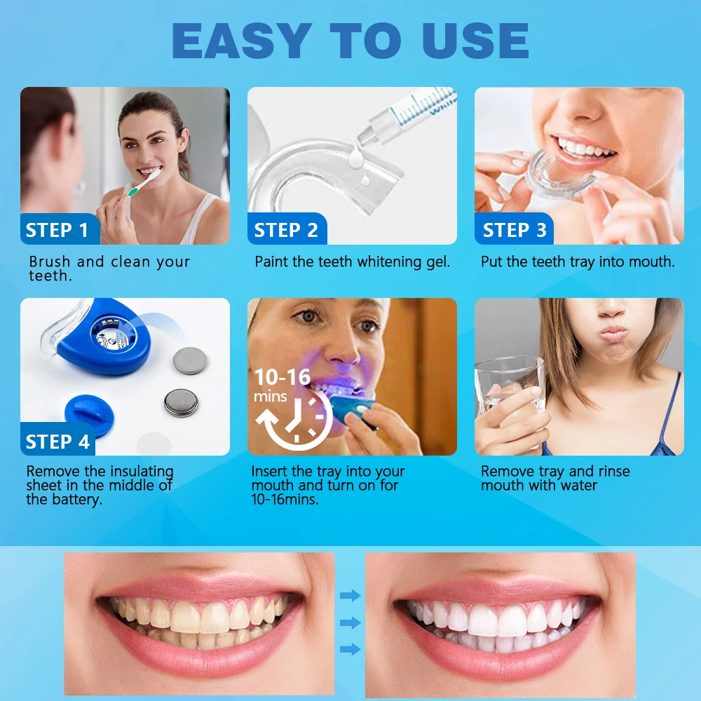 New Smilekit PAP Teeth Whitening Kit With Led Light Home Use Tooth Bleaching Gel Kits Remove Dental Stains Tools Oral Care