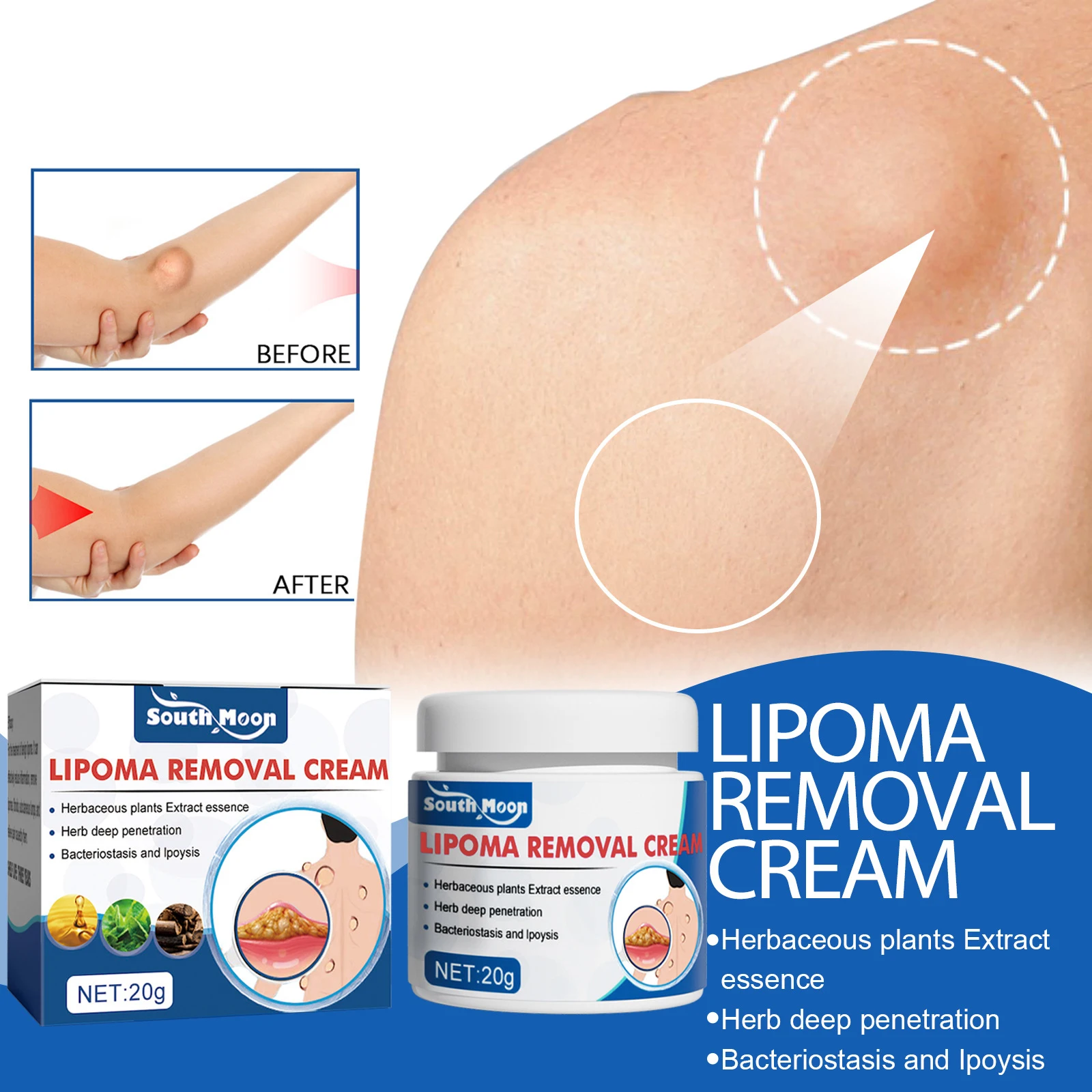 

Herbal Lipoma Removal Cream Removes Lipomas&Fibroids&Subcutaneous Lumps&For Pain Relief Medical Plaster 20g