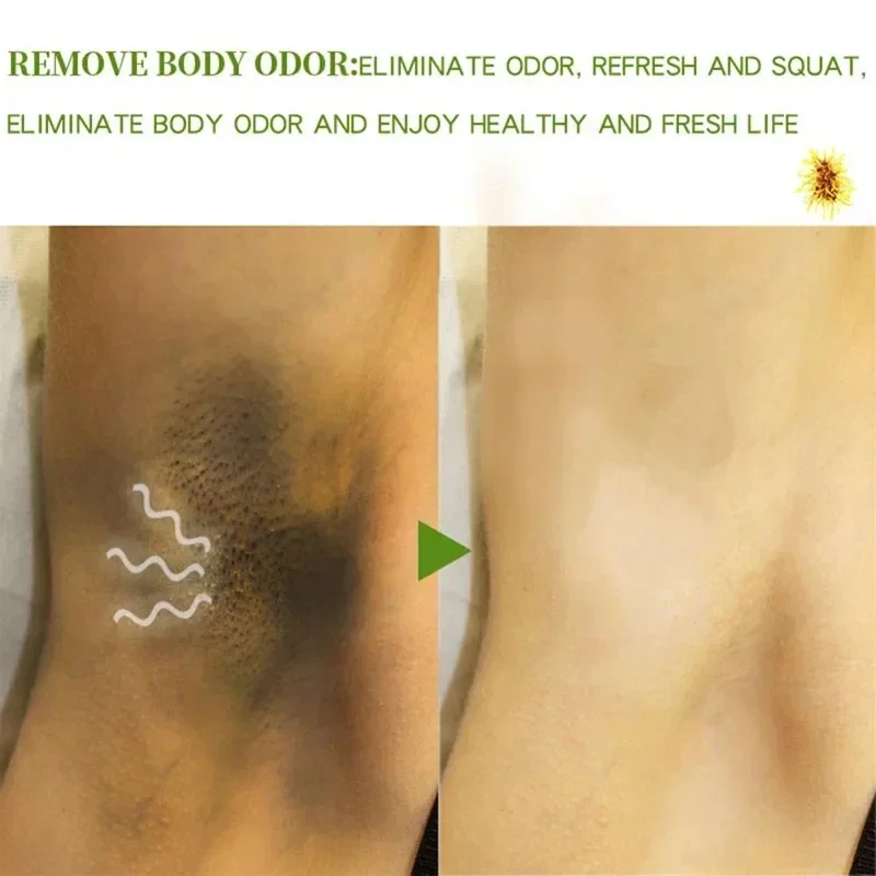 Body Odor Spray Underarm Deodorants Long Lasting Antiperspirant Hair Inhibitor Sweat Hair Removal Eliminate Bad Smell Skin Care deodorant spray