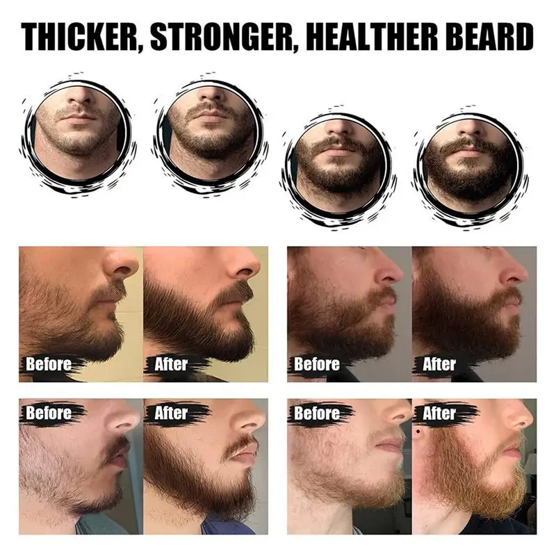 5pcs Beard Growth Kit Hair Growth Enhancer Thicker Oil Nourishing Leave-in Conditioner Beard Growth Solution Beard Cream comb