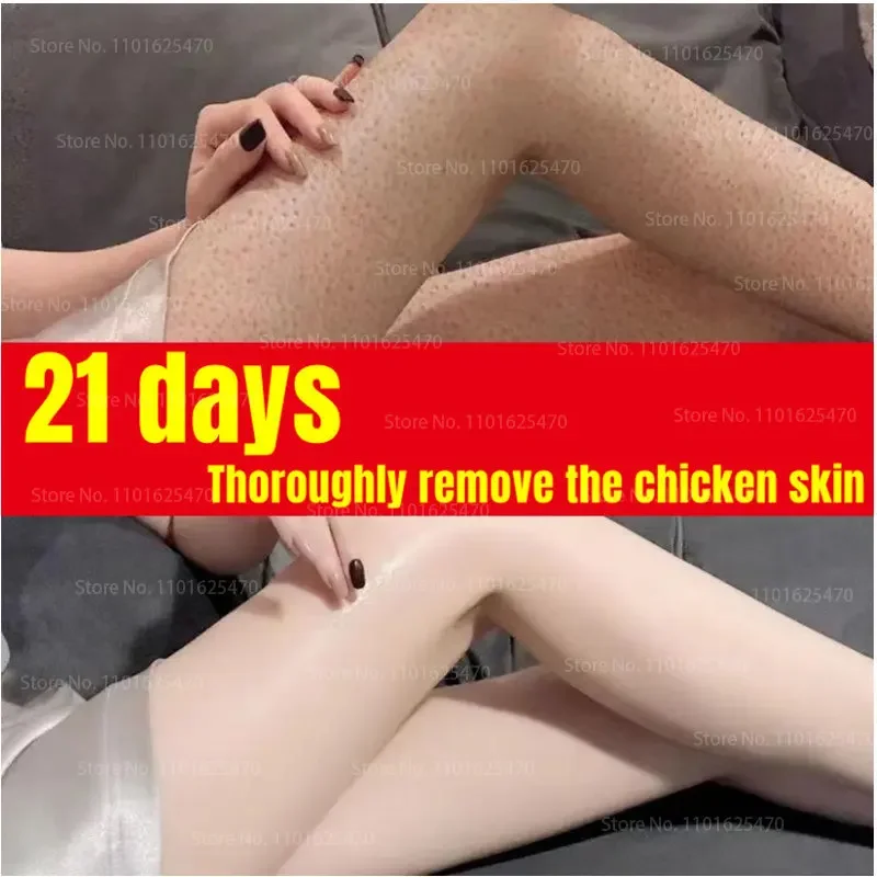 400ml Vaseline Body Milk Niacinamide Whitening Brightening Body Milk Autumn and Winter Improve Rough Chicken Skin