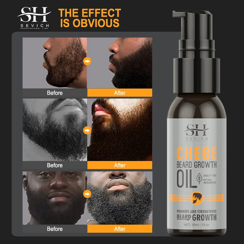 Natural Chebe Men Beard Growth Oil Fast Effective Beard Growth Essential Hair Loss Treatment Product Sevich Beard Care Serum 4