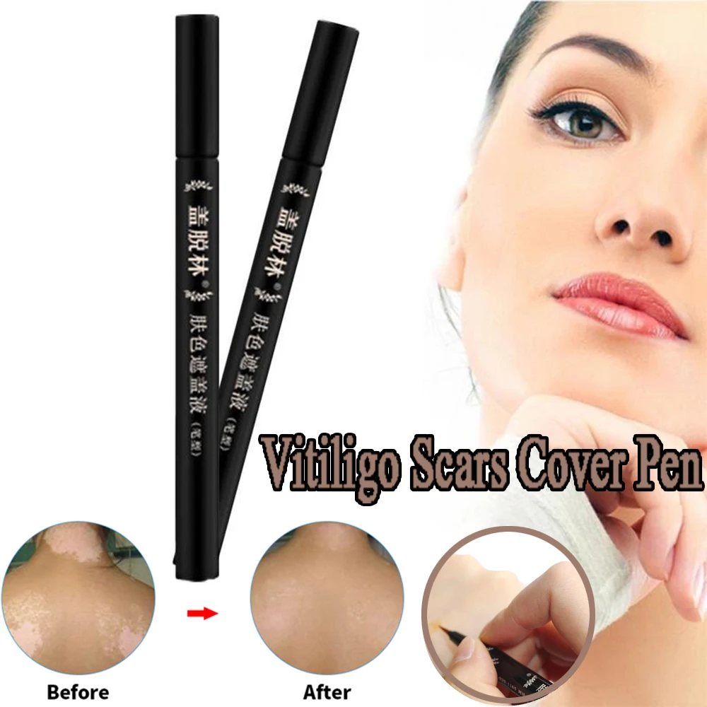 

Vitiligo Scars Birthmarks Cover Pen Professional White Spots Tattoo Concealer Herbal Plant Essence Skin Cover Pen