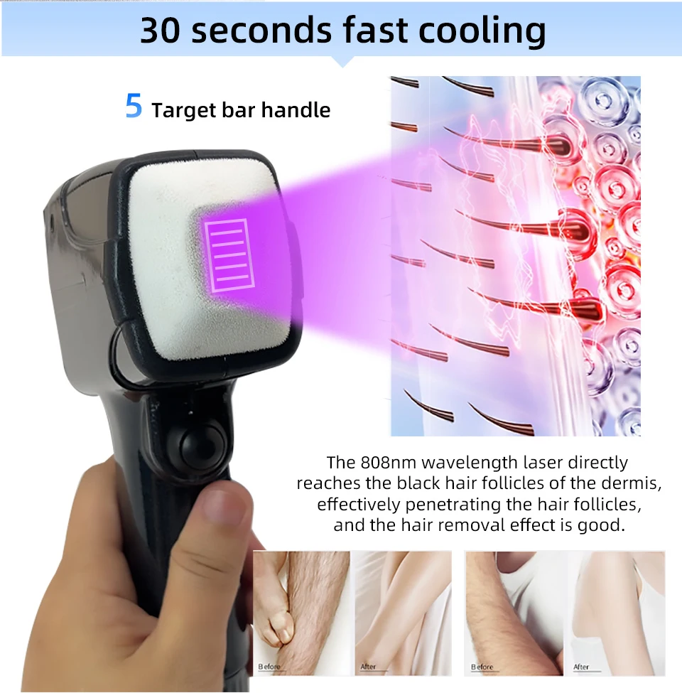 Newest Design Professional 808nm Diode Laser 2000w Permanent Hair Removal Machine Diode Ice Titanium Laser Body Hair Removal SPA