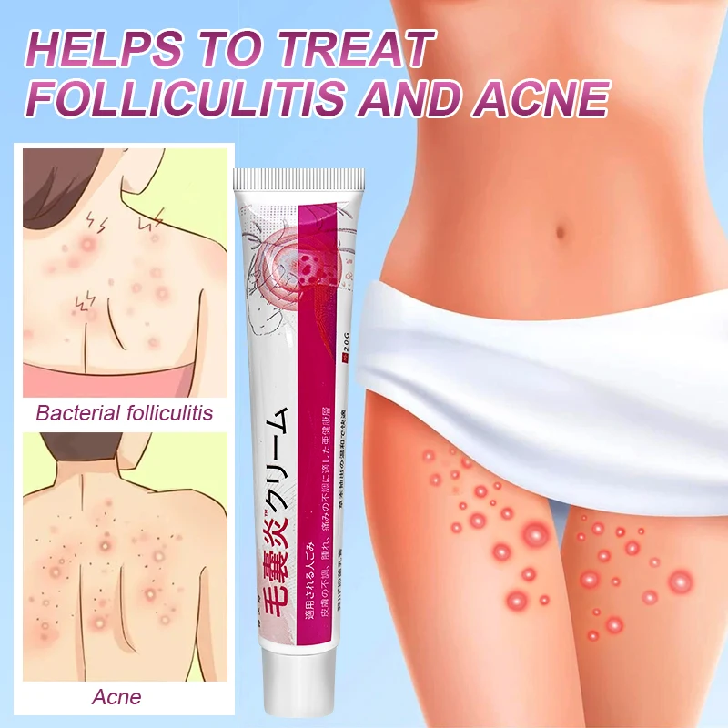 3Pcs Folliculitis Psoriasis Cream Treat Dermatitis Eczematoid Antibacterial Anti-Itch Herbal Medical Skin Care Ointment A1712