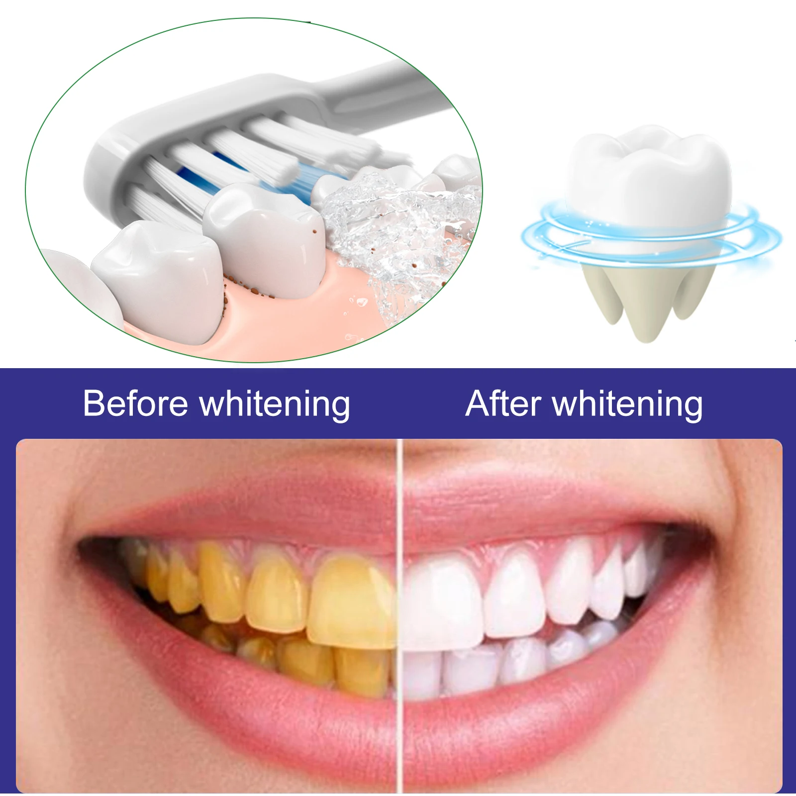 Eelhoe Nicotinamide Toothpaste Removes Tooth Stains Tartar Dazzler Toothpaste Freshens Breath Clean Mouth Brightening Toothpaste